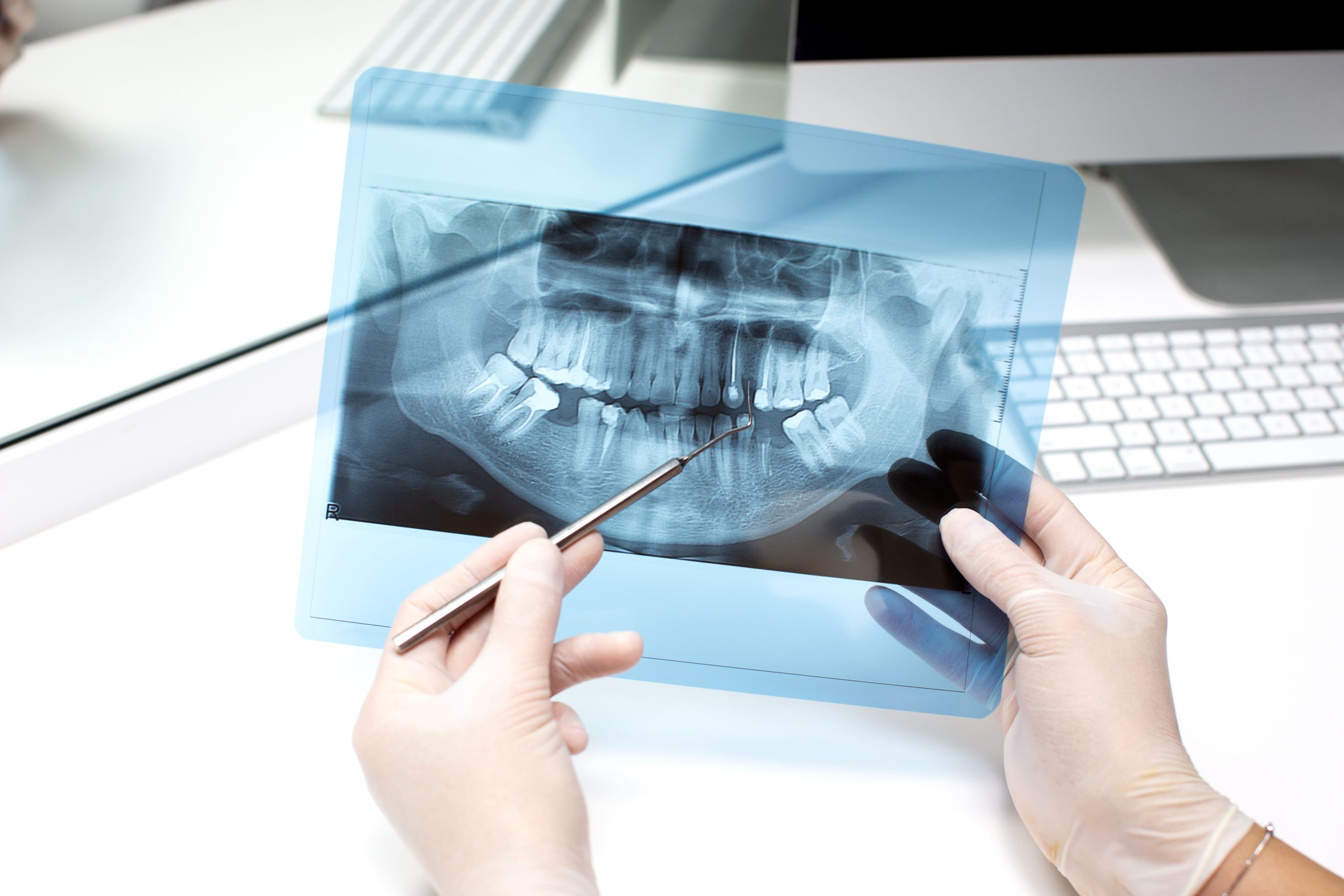 dentista-analiza-foto-de-rayos-x